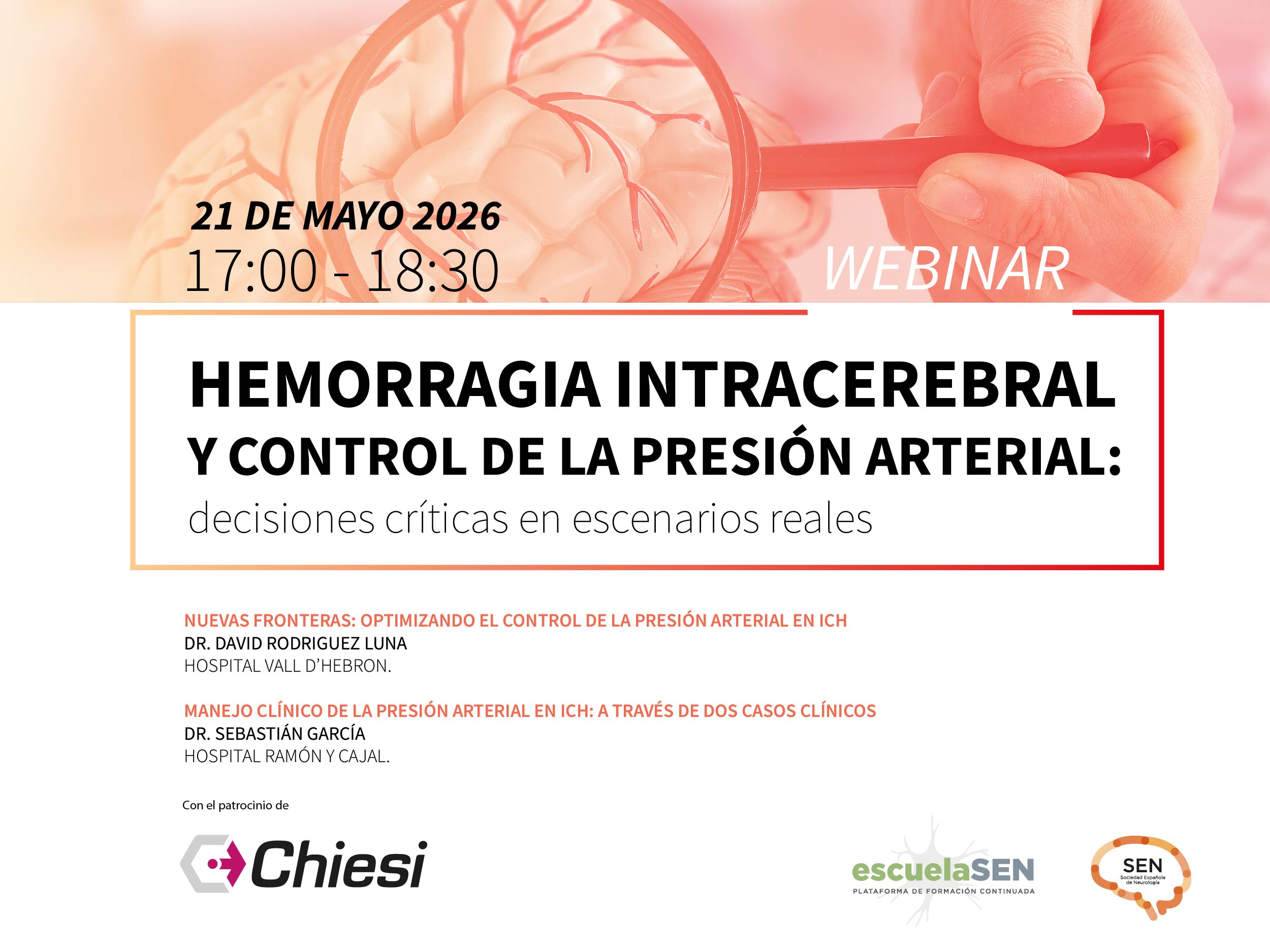 Hemorragia intracerebral y control de la presión arterial: decisiones críticas en escenarios reales